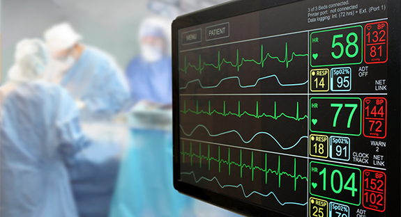 Value Engineered Cardiac Implant Monitoring System